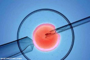 三代试管代怀生子
